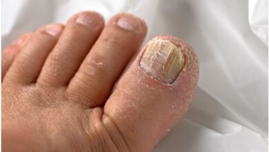 When Should You Seek Medical Help for Pus Under the Toenail?